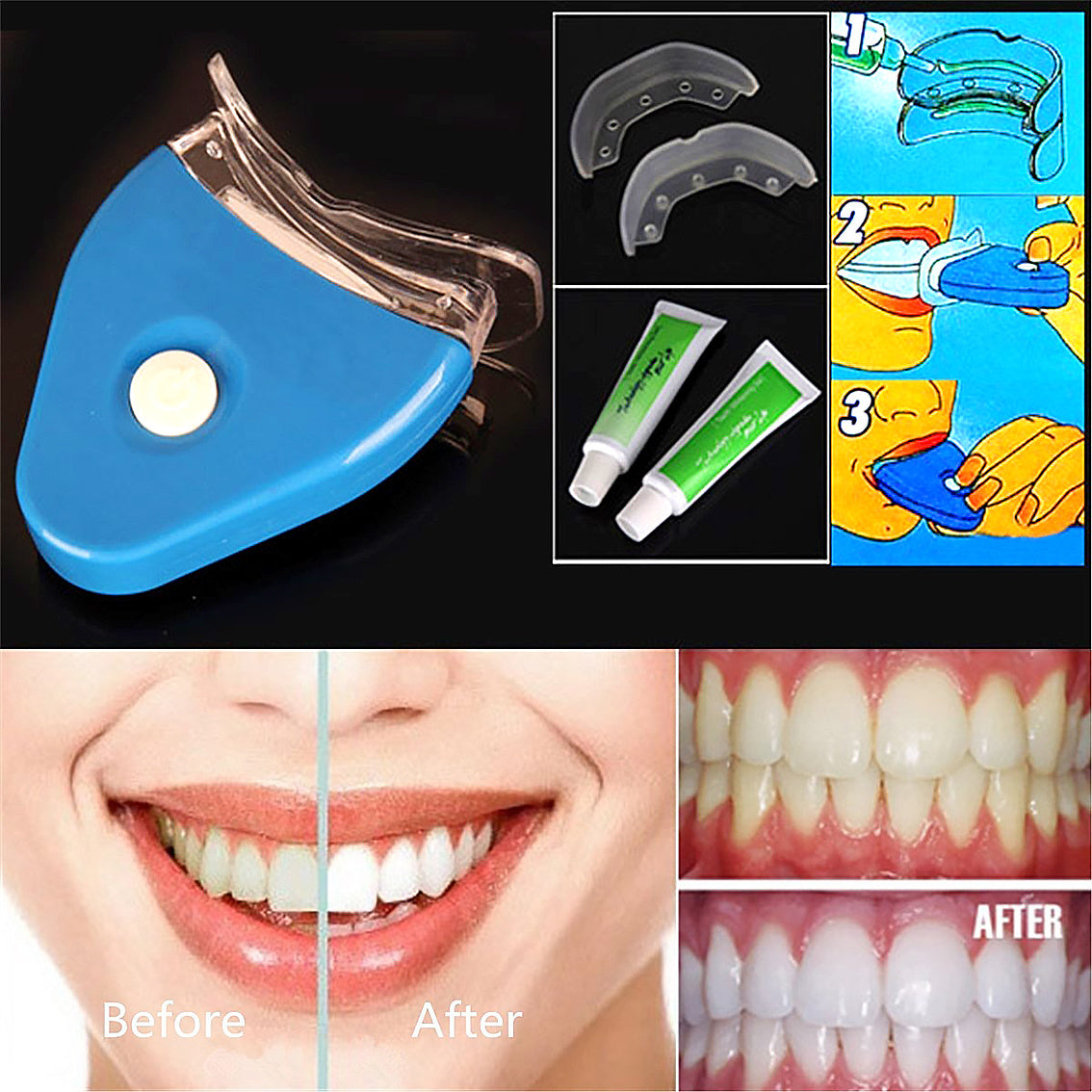 Oral Gel Teeth Tooth Whitening Whitener Dental LED